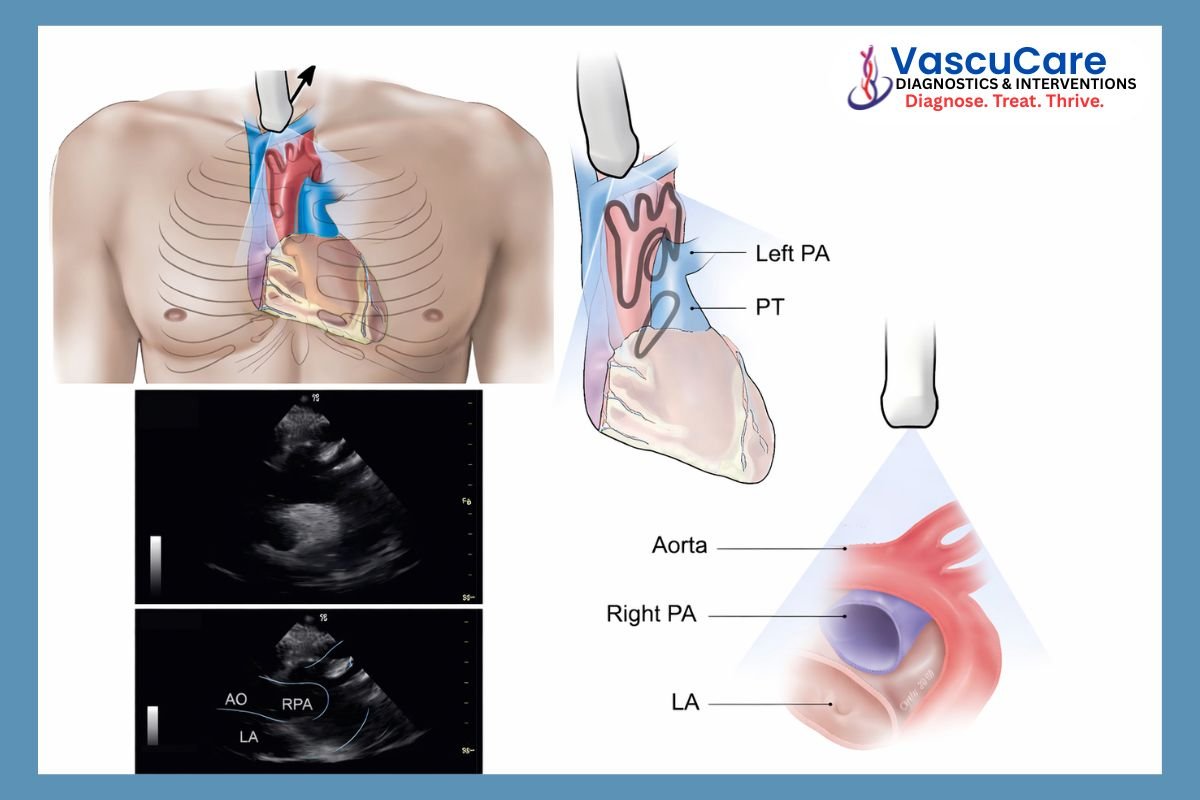 Cardiac ECHO Cardiac ECHO
