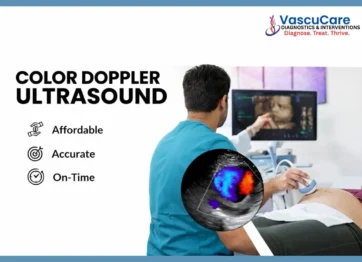Color Doppler Ultrasound