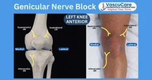 Non-Surgical Treatment