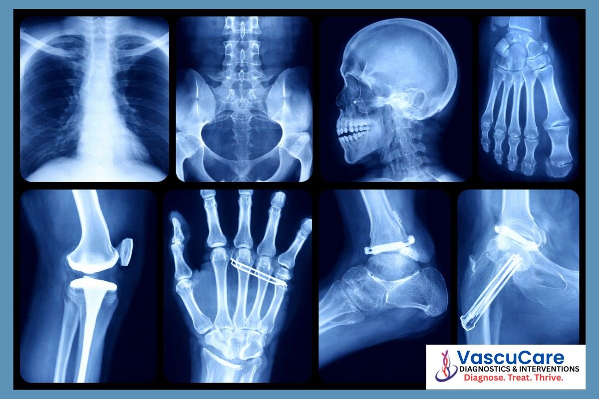 X-Ray Imaging A Complete Guide