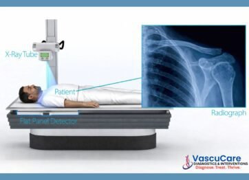 X-Ray Imaging A Complete Guide