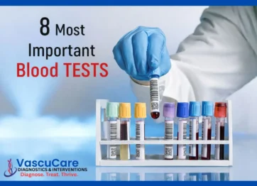 Blood Test Lab Near Me Affordable Accurate Testing Services