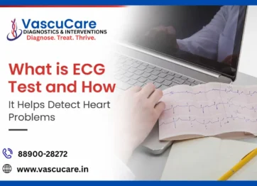 ECG Test Why It’s Important for Heart Health