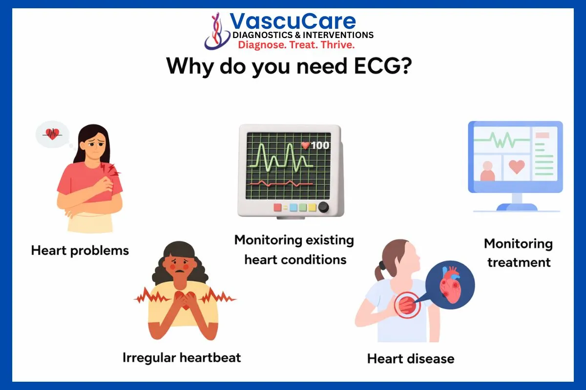 ECG Test Why It’s Important for Heart Health