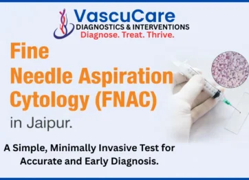 FNAC Testing Centre Near Me What to Expect Before Your Test Complete Patient Guide