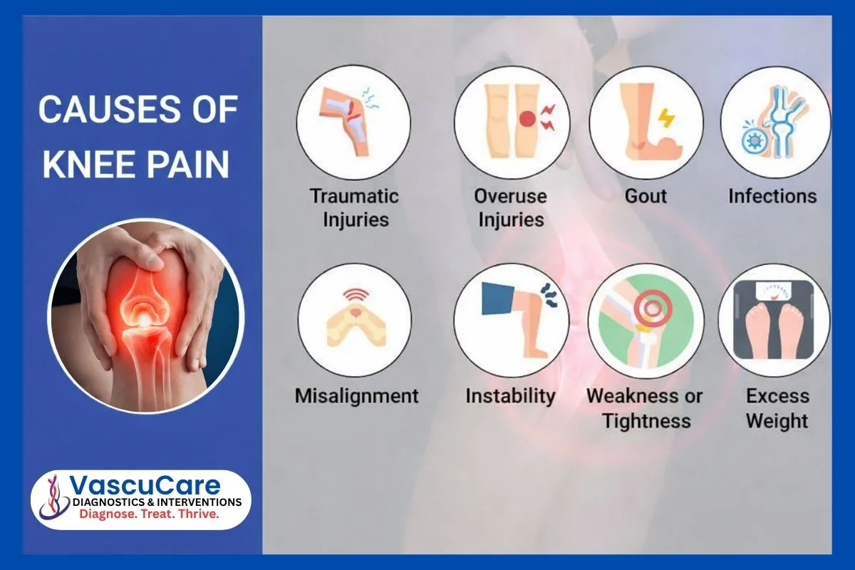 Understanding Knee Pain Causes Symptoms Treatment