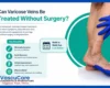 Varicose Vein Treatment in Jaipur Latest Non Surgical Options for Fast Relief