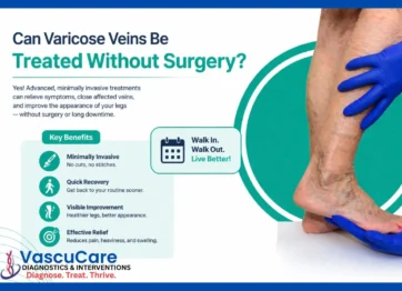 Varicose Vein Treatment in Jaipur Latest Non Surgical Options for Fast Relief