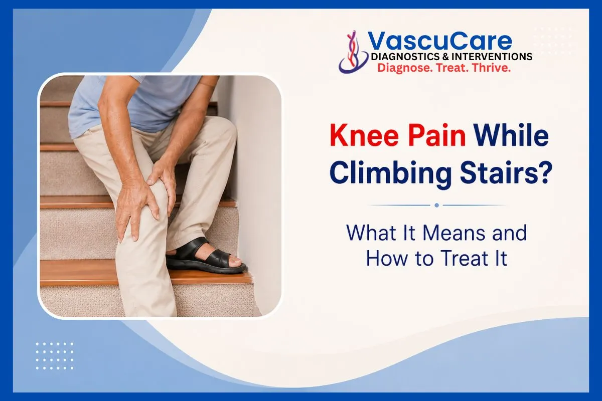 Knee Pain While Walking or Climbing _tairs Causes & Treatment Options