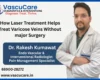 How Laser Treatment Helps Treat Varicose Veins Without Major Surgery