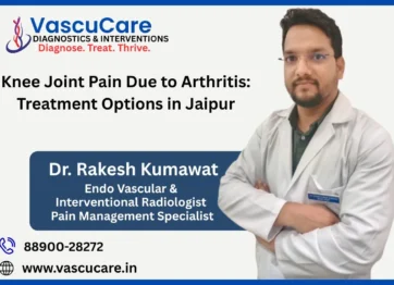 Knee Joint Pain Due to Arthritis Treatment Options in Jaipur