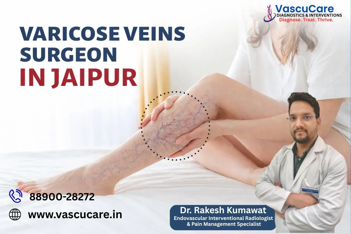 Vascular Surgery Doctor for Varicose Veins Treatment Options Explained