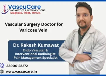 Vascular Surgery Doctor for Varicose Veins Treatment Options Explained
