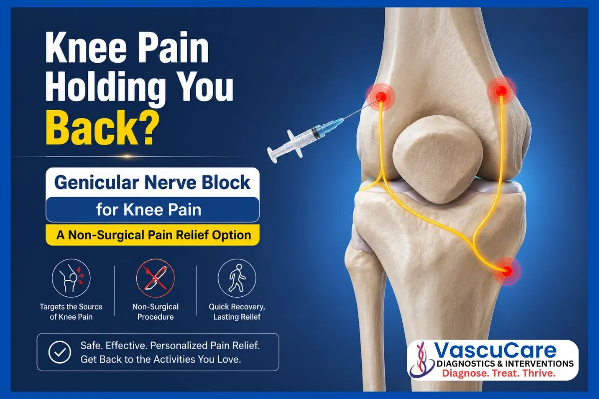 Who Should Consider Genicular Nerve Block Treatment for Knee Pain