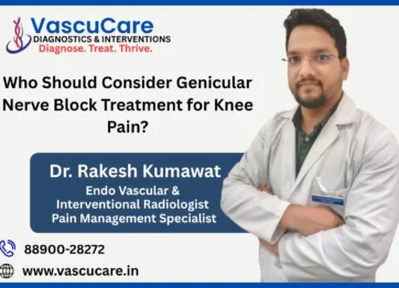 Who Should Consider Genicular Nerve Block Treatment for Knee Pain