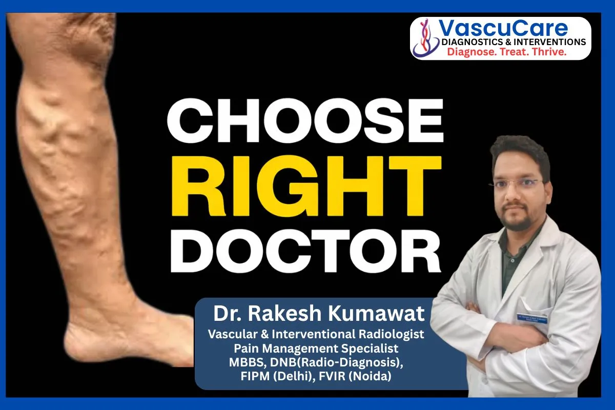 Why Consulting a Vein Specialist Early Can Prevent Serious Vein Problems