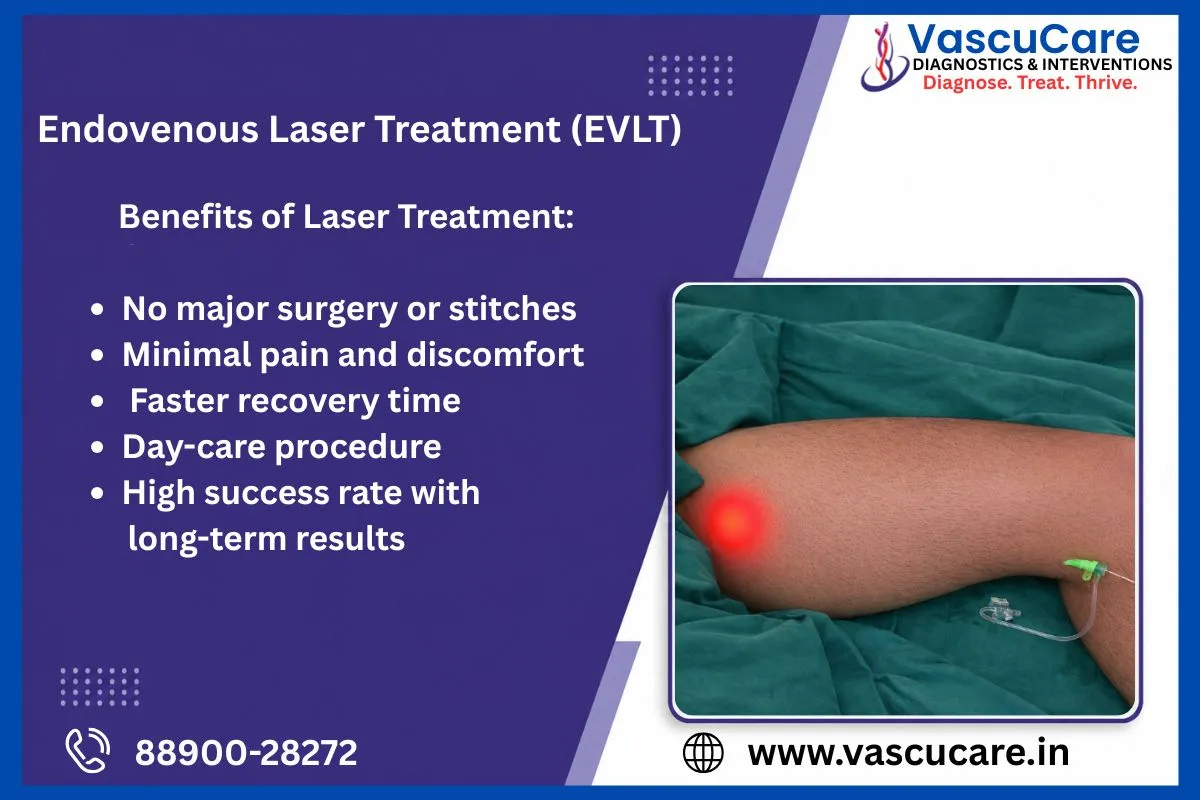 How Interventional Radiology Treats Varicose Veins Without Major Surgery