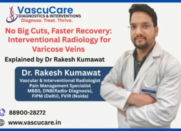No Big Cuts, Faster Recovery Interventional Radiology for Varicose Veins