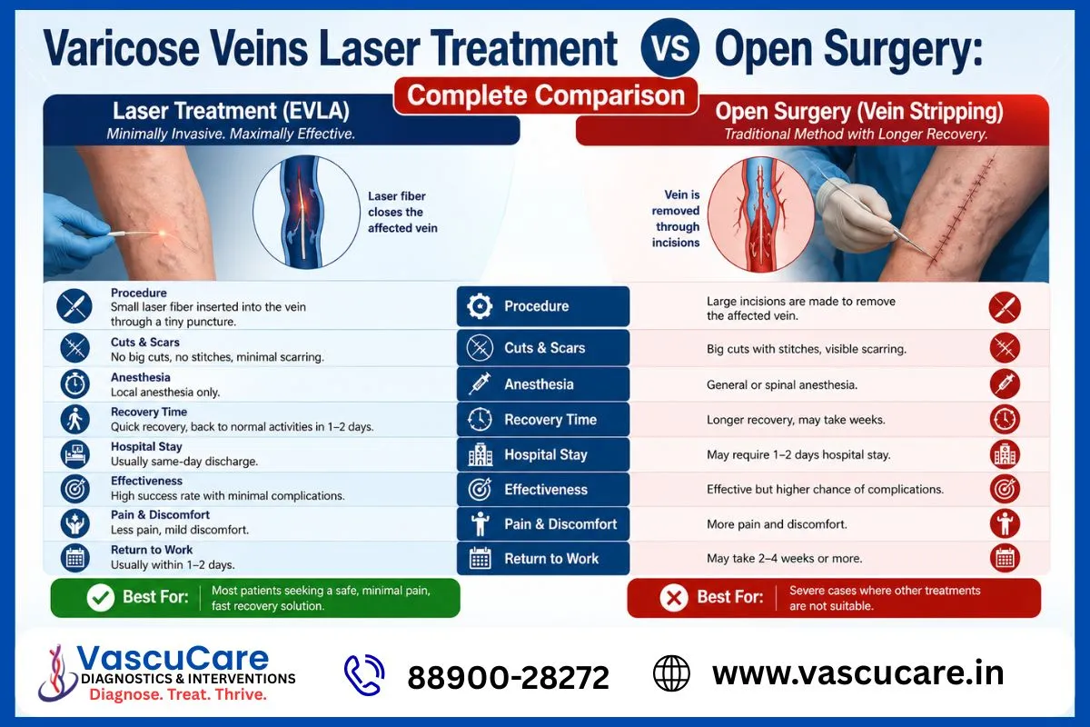 Varicose Veins Laser Treatment vs Open Surgery Complete Comparison