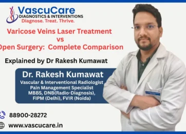 Varicose Veins Laser Treatment vs Open Surgery Complete Comparison