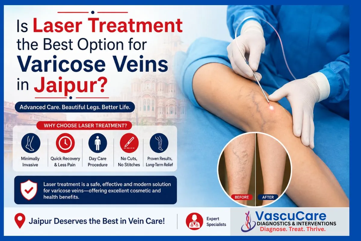 Is Laser Treatment the Best Option for Varicose Veins in Jaipur