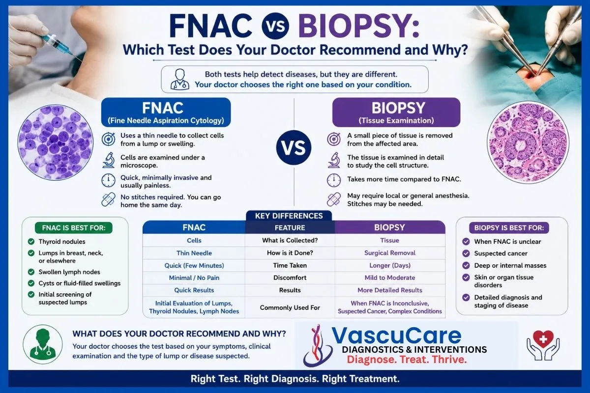 FNAC vs Biopsy Which Test Does Your Doctor Recommend and Why