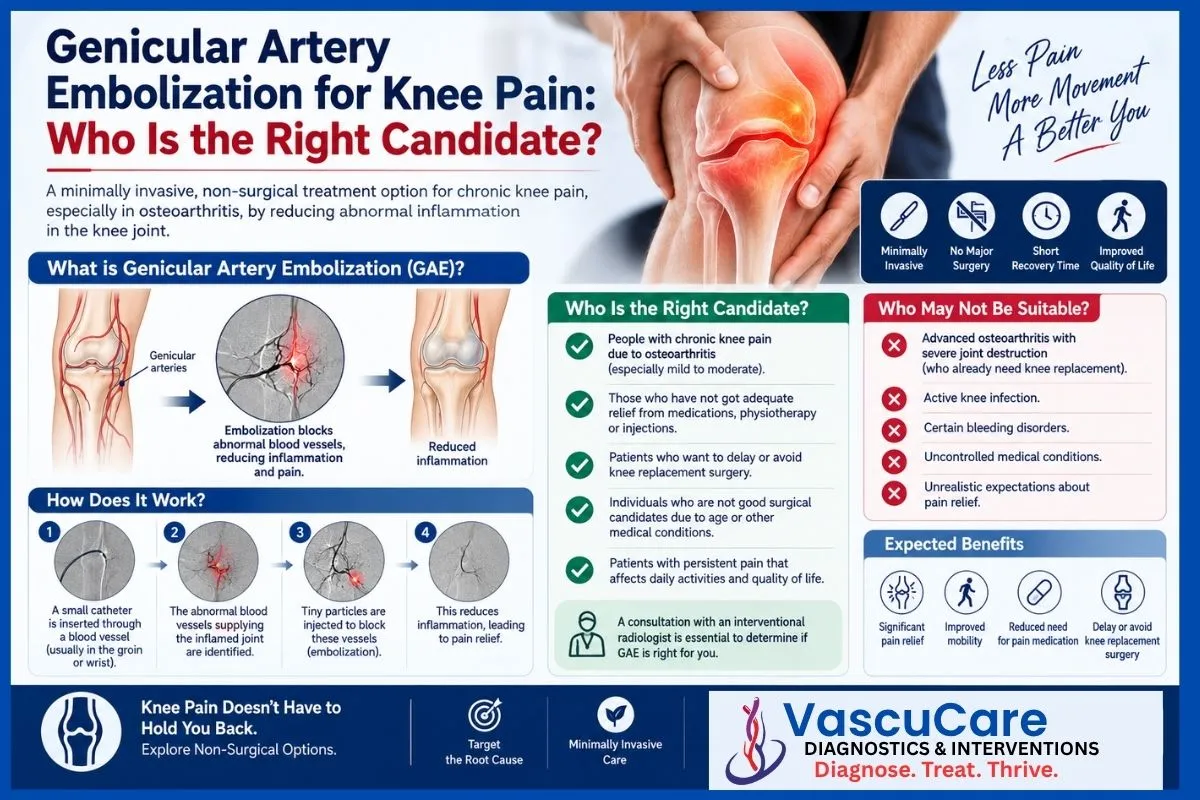 Genicular Artery Embolization for Knee Pain Who Is the Right Candidate